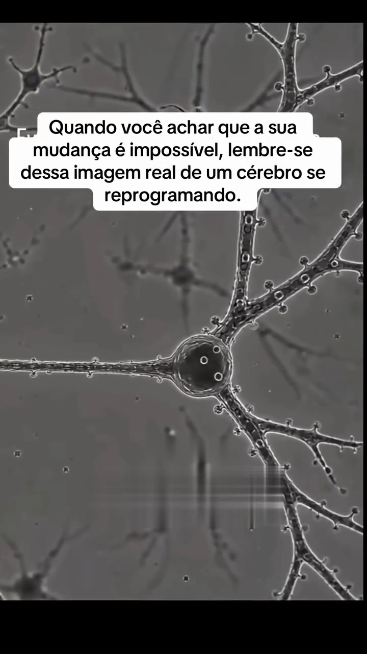 Como reprogramar o cérebro através da Neuroplasticidade